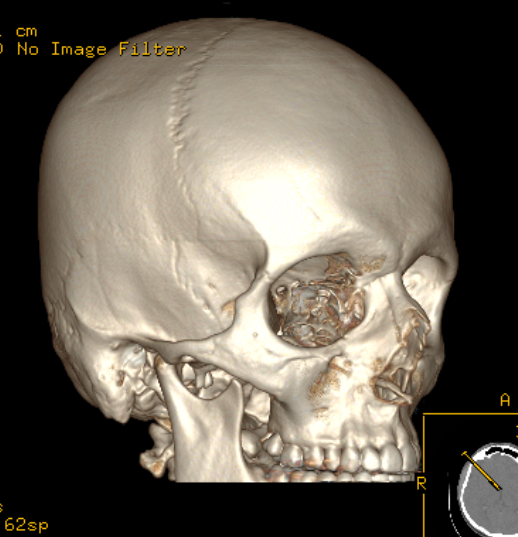 12.03.2023_14.35.58_REC